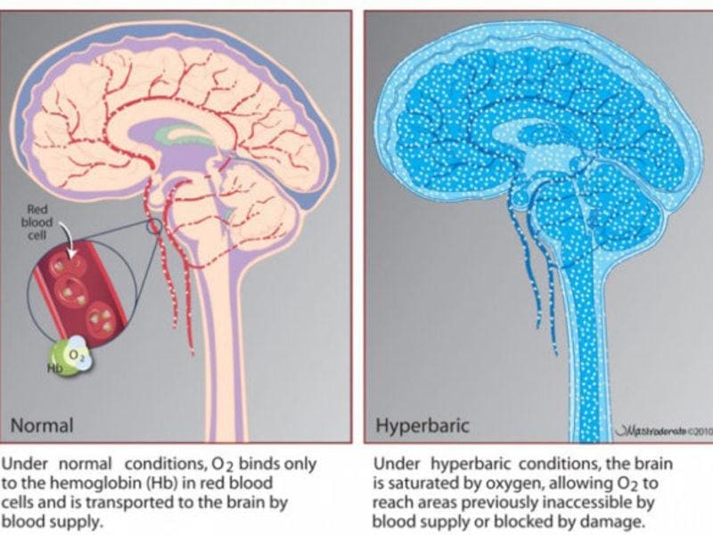 hbot and the brain